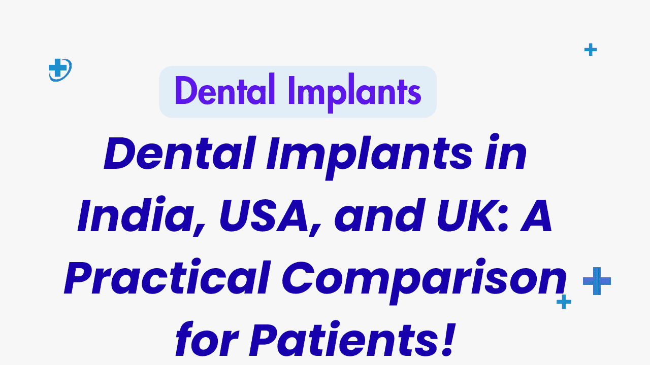 Dental-Implants