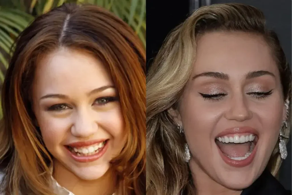 Miley Cyrus – Biography, Age, Net Worth, Career & Personal Life
